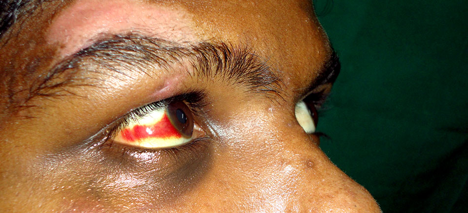 orbit-fracture-cover