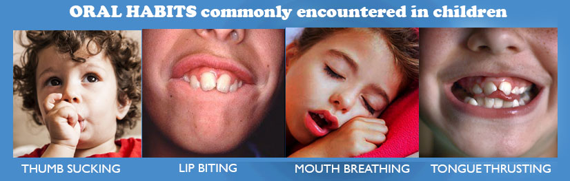 Oral habbits in children