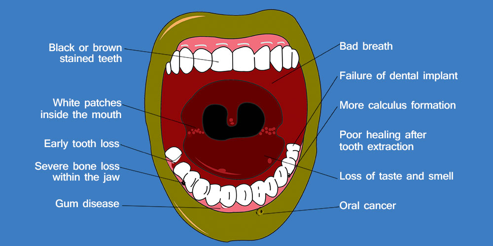dangers-of-smoking